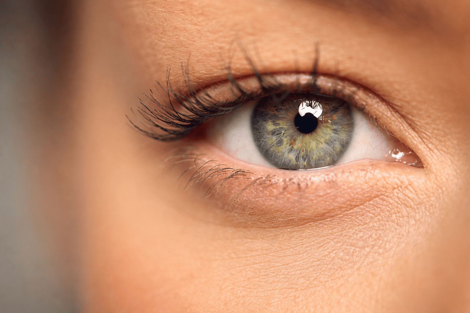Irisdiagnose